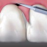 Smaganu Trimmers